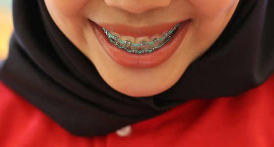 Innovative OnBRACE Technology in Action