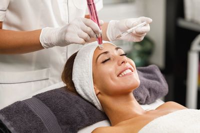 microneedling in guildford