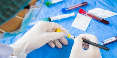 Gloved hands labeling test tube.