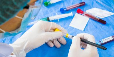 A scientist handling a blood sample with a pipette in a lab setting.