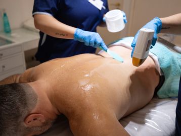 A man receiving laser hair removal treatment on his back.