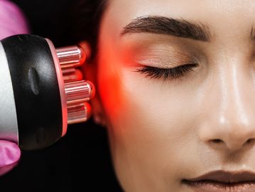 RF Radio Frequency ,skin tightening