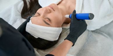 SkinPen microneedling, skin treatment