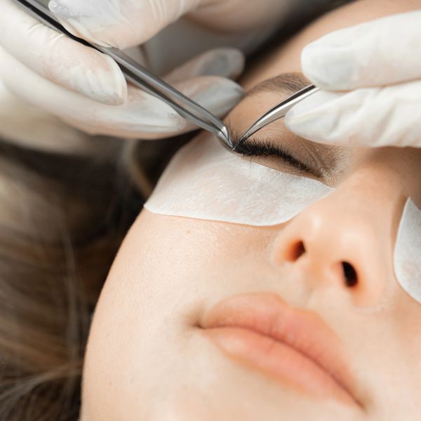 Close-up of eyelash extension application on a woman with protective pads under her eyes.