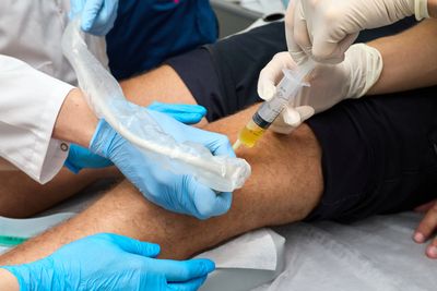 Doctor injecting PRP into a patient's knee using ultrasound.