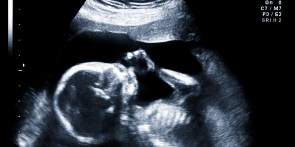 Fetal ultrasound scan in retro style.