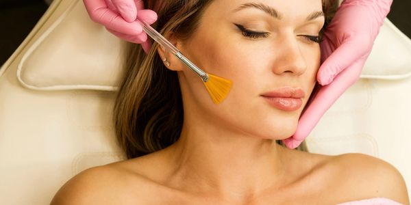 Woman receiving a professional chemical peel facial treatment.
