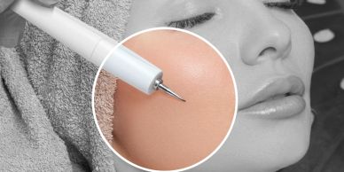 Close-up of facial microneedling treatment.