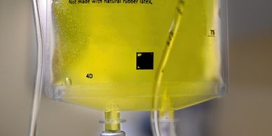 Close-up of a yellow liquid IV bag used for medical treatments.