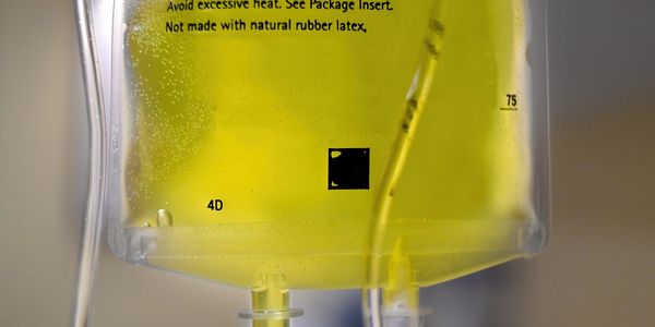 Myers Cocktail - Bright Yellow IV hydration bag upclose