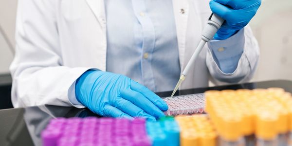 Scientist using a pipette to transfer liquid samples into a multi-well plate in a lab.