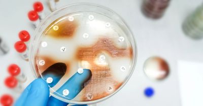 Petri dish with bacterial cultures held by gloved hand.