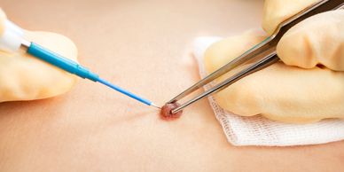 Surgical Dermatology