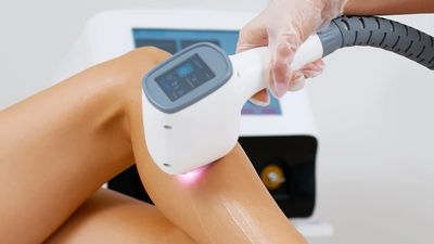 lincoln permanent hair removal 
