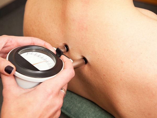 Person measuring body fat with skinfold caliper on back.