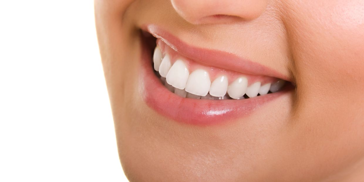 Close-up of a smiling mouth with white teeth.