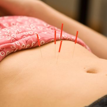 fertility acupuncture