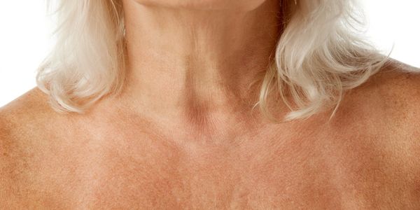 Chest skin care Columbus GA