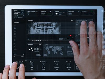 Hands interacting with a dental X-ray interface on a tablet.
