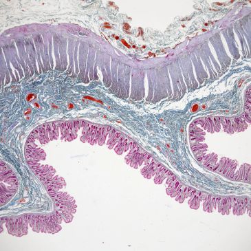 Microscopic view of stained tissue showing cellular structures.