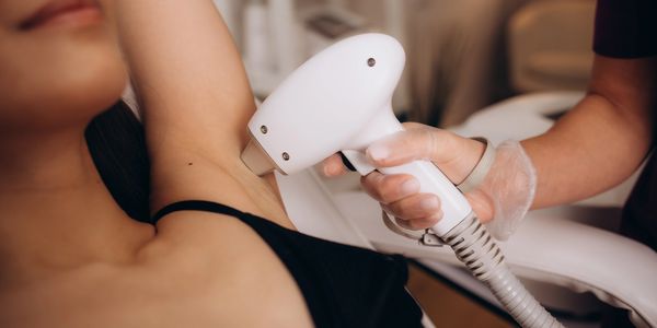 Technician performing IPL hair removal on a patient's underarm.