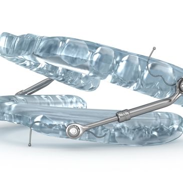 Sleep Apnea Appliance