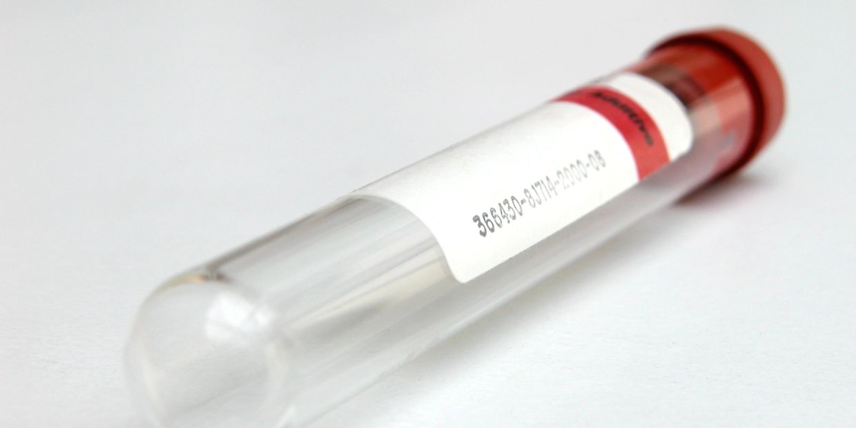 Close-up of a test tube with a red cap and label.