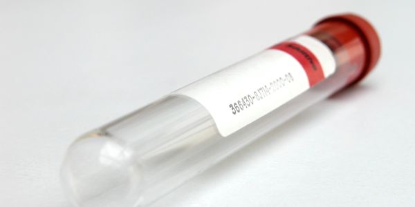 Close-up of a test tube with a red cap and label.