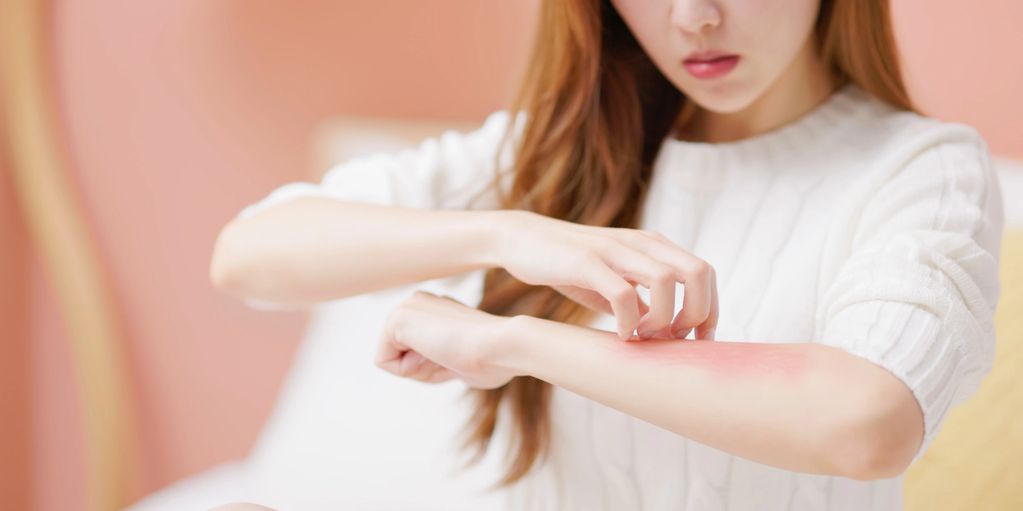 A young woman scratching her for arm and it has a red patch