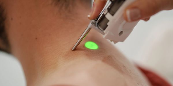 Dermatology Laser Treatments for Skin & Hair