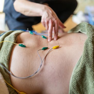 Person undergoing electroacupuncture treatment on abdomen.