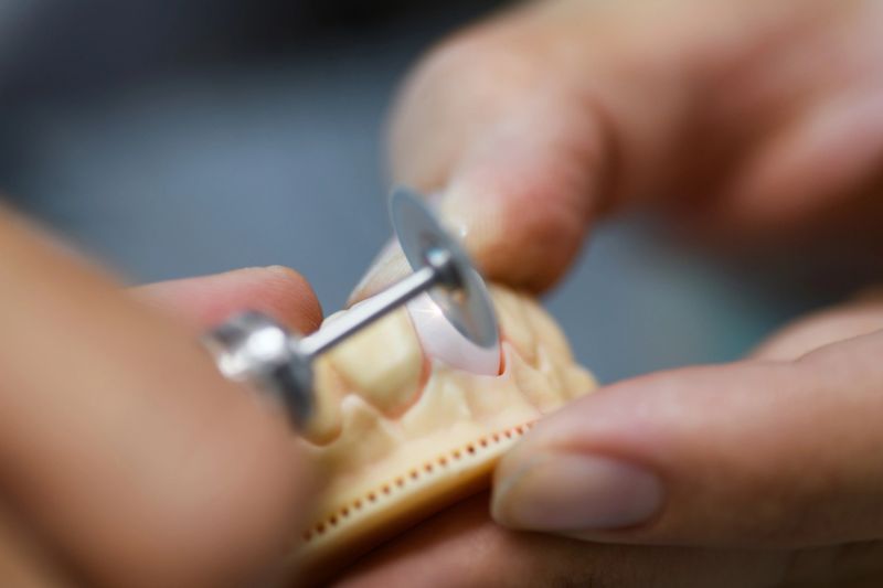 Close up of prosthetic dental craftsmanship, showcasing the detailed work of creating a dental prosthesis