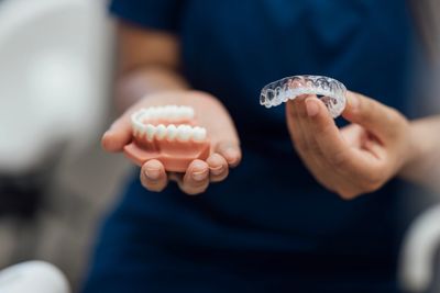 Hands holding dental mold and clear aligner.