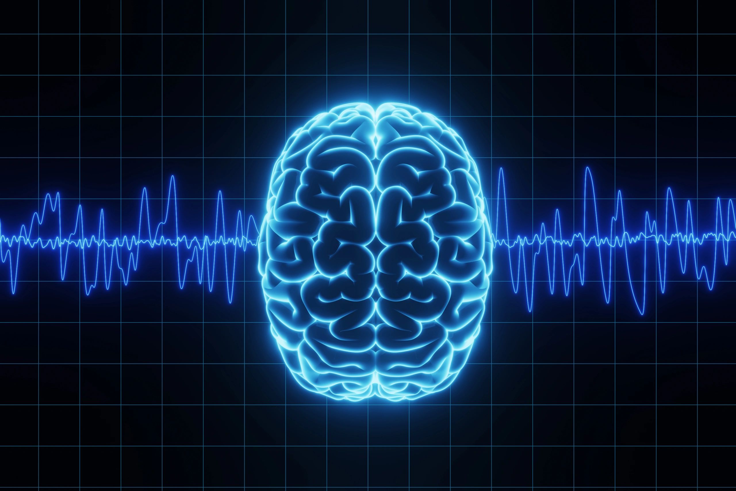 How Neurofeedback Works