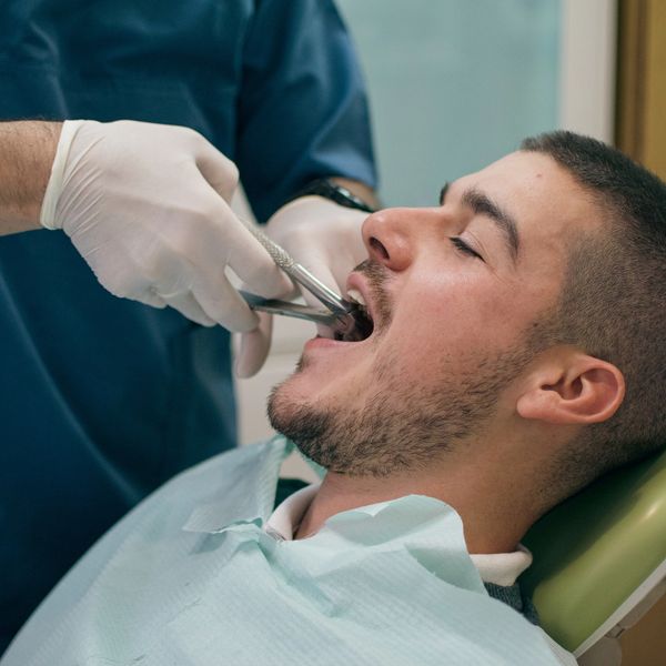 Extraction, Wisdom teeth