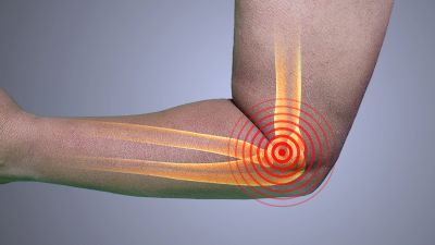 Illustration of elbow pain with target mark.