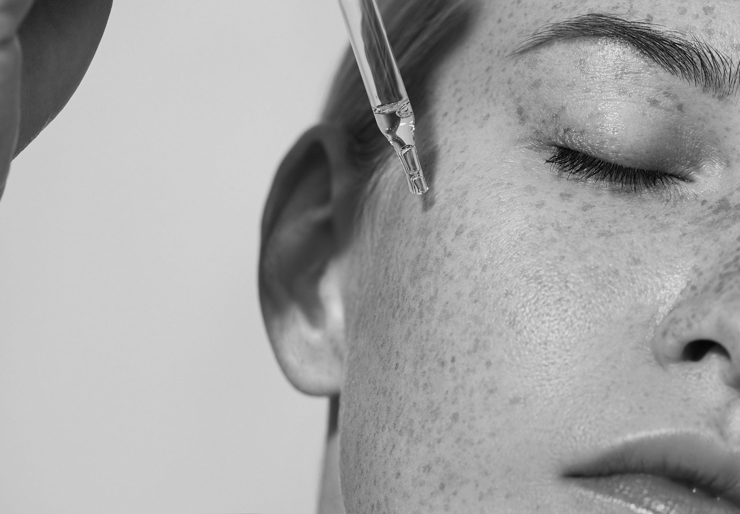 Close-up of a woman with freckles receiving a skincare serum applied near the eye with a dropper.