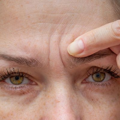Brisbane's number 1# Anti wrinkle treatments, say goodbye to fine lines and wrinkles, smooth away