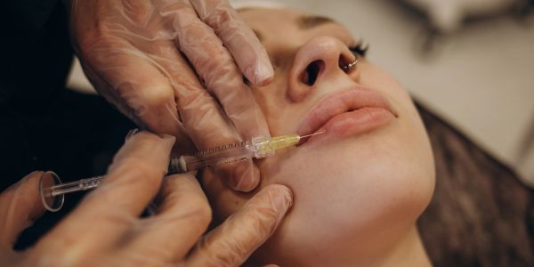 Injecting lip filler into lips.