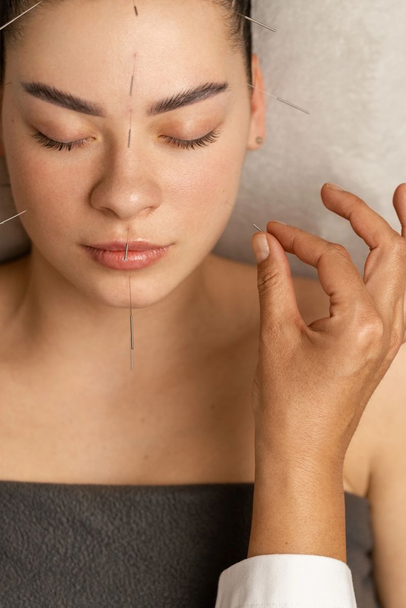 Acupuncture specialist inserting needle into patient's face due treatment. She is stimulating energy flow through the body for faster relaxation and recovery.