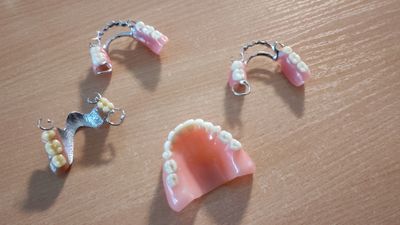 Complete and partial dentures created with digital precision at Save Dental in Orem, Utah — restorin