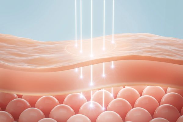 Illustration of light penetrating skin layers to target cells below.