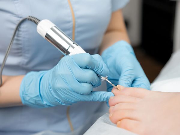 A podiatrist uses a tool to treat a toenail in a clinical setting.