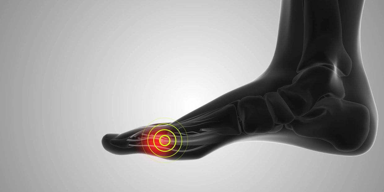 Many peripheral neuropathy sufferers aren't chemotheraphy or diabetes patients