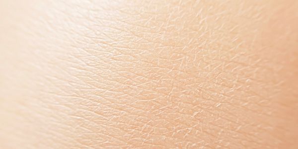 Close-up of dry, flaky skin texture.