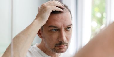 Man examining his thinning hair in the mirror with concern.