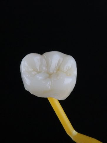 CEREC Crown