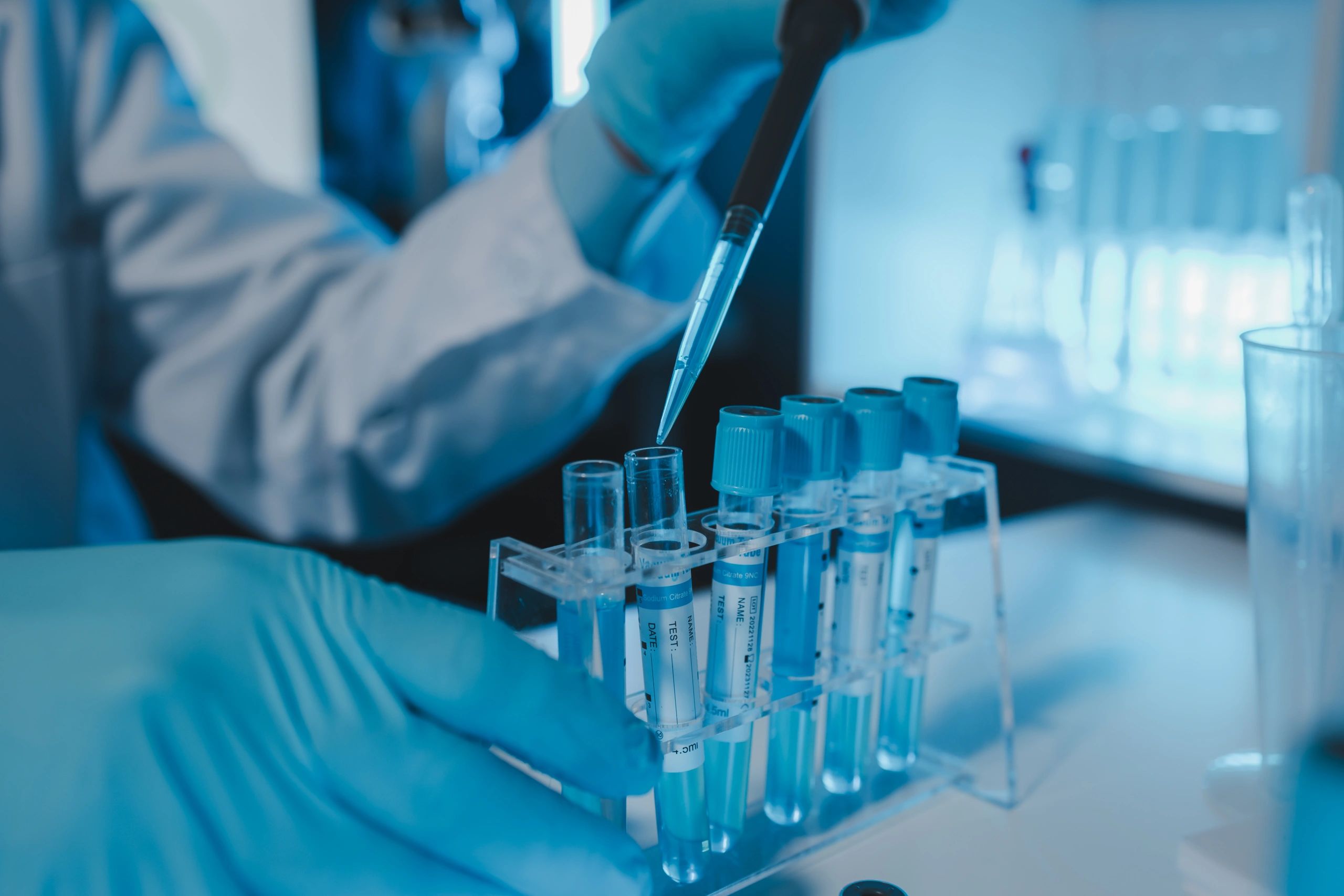 Scientist using a pipette to transfer liquid into test tubes in a laboratory.