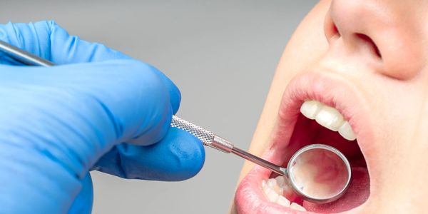 Routine dental check-up at Myrtle Dental Clinic South Morang