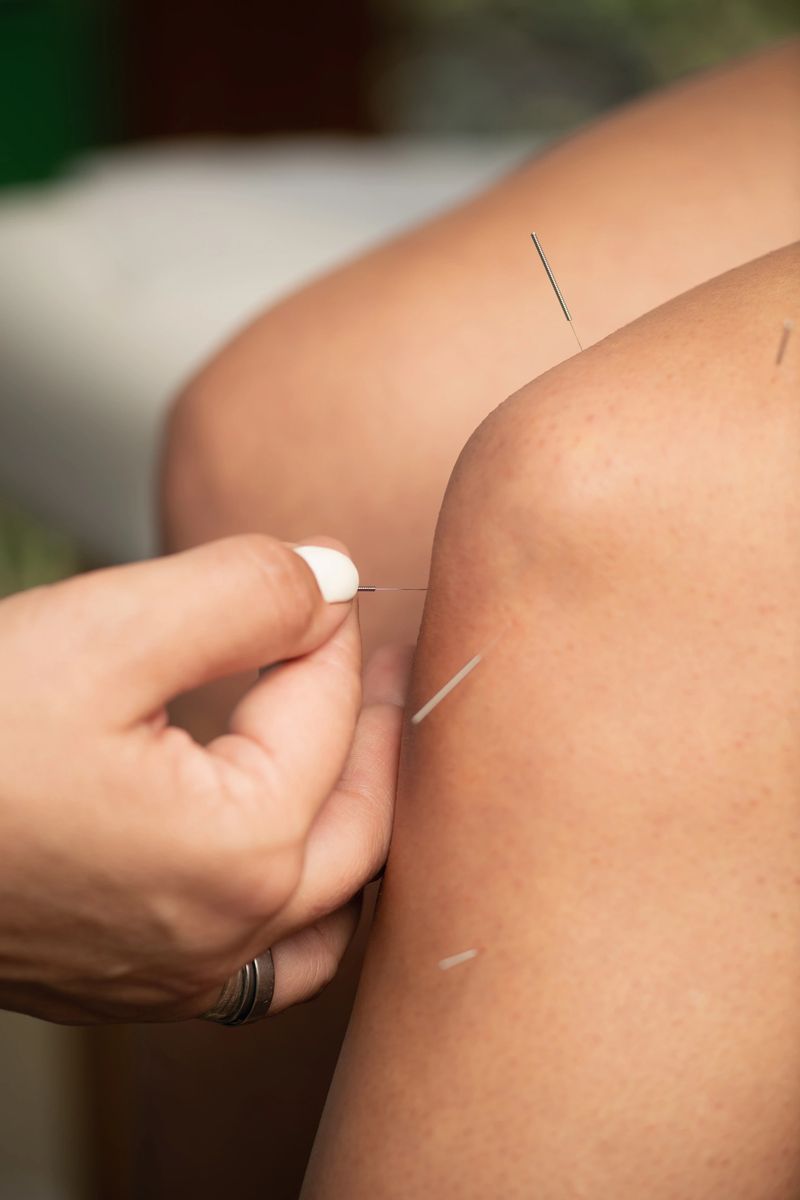 Acupuncture for relieving osteoarthritis knee pain